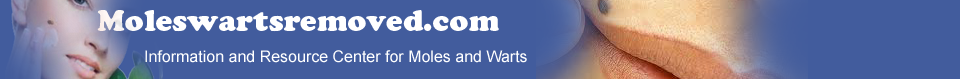 Moles And Warts - Information and Resource Center